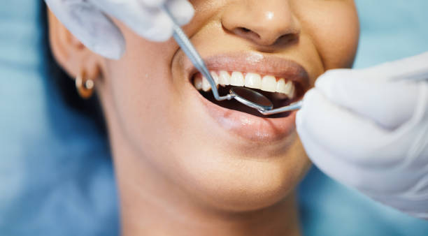 Best Emergency Treatment for Toothache in Cartervle, IL